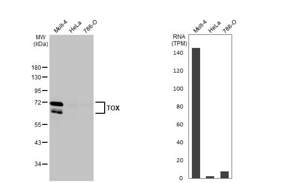 Various whole cell extracts (30 ug) were separated by 10% SDS-PAGE, and the membrane was blotted with TOX antibody [HL1809] (NBP3-48665) diluted at 1:1000. The HRP-conjugated anti-rabbit IgG antibody was used to detect the primary antibody. Corresponding RNA expression data for the same cell lines are based on Human Protein Atlas program. 