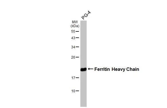 Whole cell extract (30 ug) was separated by 12% SDS-PAGE, and the membrane was blotted with Ferritin Heavy Chain antibody [HL1905] (NBP3-48666) diluted at 1:1000. The HRP-conjugated anti-rabbit IgG antibody was used to detect the primary antibody. 