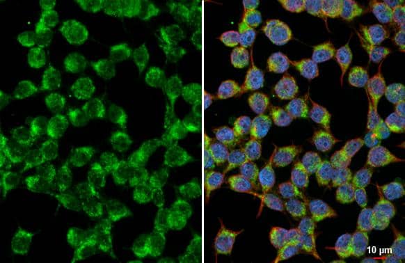 Immunocytochemistry/ Immunofluorescence NDUFS3 Antibody (HL2097)