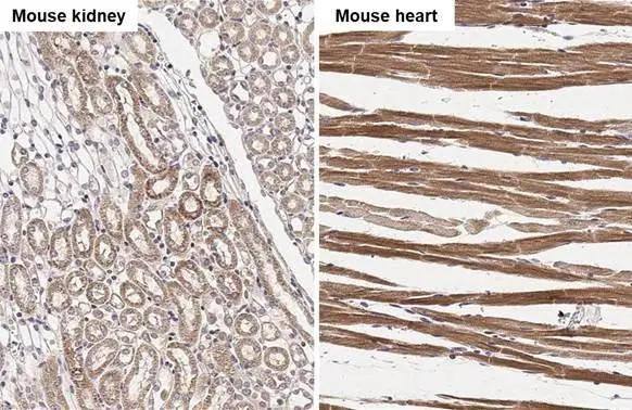 NDUFS3 antibody [HL2097] detects NDUFS3 protein by immunohistochemical analysis.Sample: Paraffin-embedded mouse tissues.NDUFS3 stained by NDUFS3 antibody [HL2097] (NBP3-48671) diluted at 1:50.Antigen Retrieval: Citrate buffer, pH 6.0, 15 min 