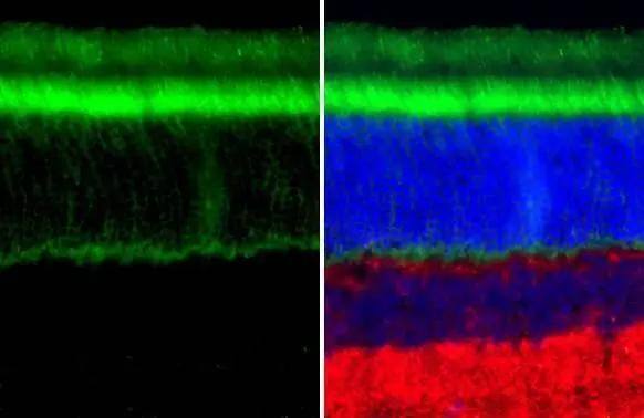 Transducin alpha antibody [HL2126] detects Transducin alpha protein by immunohistochemical analysis.Sample: Paraffin-embedded rat eye.Green: Transducin alpha stained by Transducin alpha antibody [HL2126] (NBP3-48672) diluted at 1:100.Red: beta Tubulin 3/ Tuj1 stained by beta Tubulin 3/ Tuj1 antibody [GT11710] diluted at 1:500.Blue: Fluoroshield with DAPI .Antigen Retrieval: Citrate buffer, pH 6.0, 15 min 