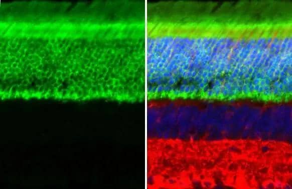 Immunohistochemistry-Paraffin Transducin alpha Antibody (HL2126)