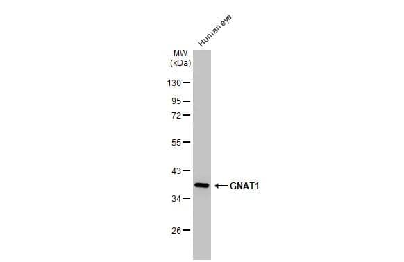 Western Blot Transducin alpha Antibody (HL2126)