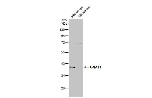 Western Blot Transducin alpha Antibody (HL2126)
