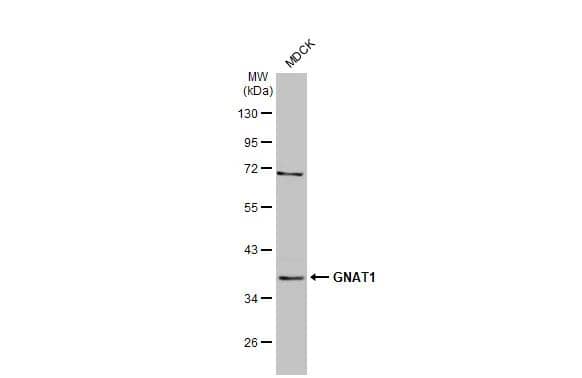 Whole cell extract (30 ug) was separated by 10% SDS-PAGE, and the membrane was blotted with Transducin alpha antibody [HL2126] (NBP3-48672) diluted at 1:3000. The HRP-conjugated anti-rabbit IgG antibody was used to detect the primary antibody. 