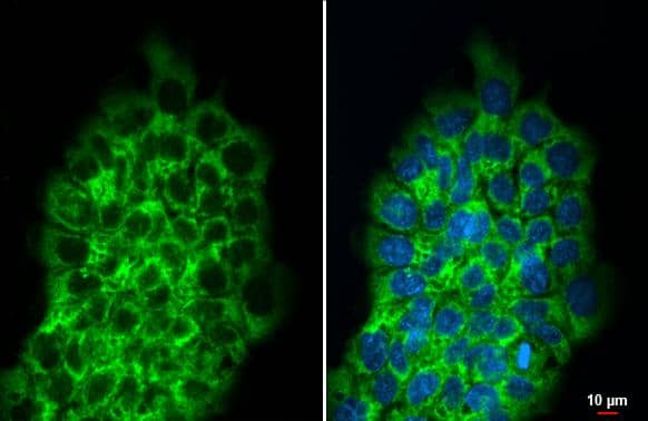 RPLP2 antibody [HL2256] detects RPLP2 protein at cytoplasm by immunofluorescent analysis.Sample: A431 cells were fixed in ice-cold MeOH for 5 min.Green: RPLP2 stained by RPLP2 antibody [HL2256] (NBP3-48674) diluted at 1:500.Blue: Fluoroshield with DAPI . 