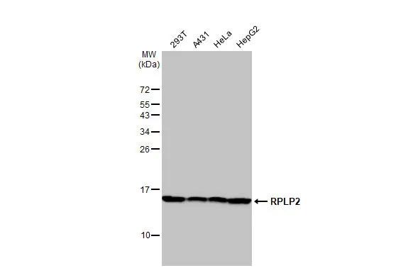 Western Blot RPLP2 Antibody (HL2256)