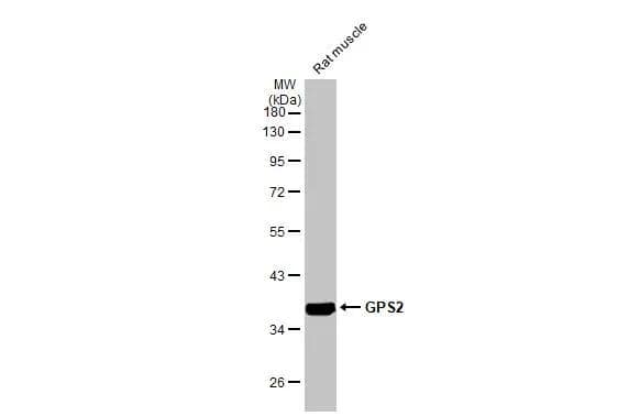 Rat tissue extract (50 ug) was separated by 10% SDS-PAGE, and the membrane was blotted with GPS2 antibody [HL2276] (NBP3-48675) diluted at 1:10000. The HRP-conjugated anti-rabbit IgG antibody was used to detect the primary antibody. 