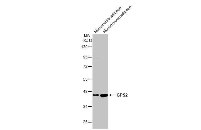 Various tissue extracts (30 ug) were separated by 10% SDS-PAGE, and the membrane was blotted with GPS2 antibody [HL2276] (NBP3-48675) diluted at 1:1000. The HRP-conjugated anti-rabbit IgG antibody was used to detect the primary antibody. 