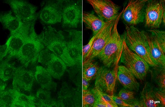 RPL32 antibody [HL2331] detects RPL32 protein by immunofluorescent analysis.Sample: MDCK cells were fixed in ice-cold MeOH for 5 min.Green: RPL32 stained by RPL32 antibody [HL2331] (NBP3-48676) diluted at 1:500.Red: alpha Tubulin, a cytoskeleton marker, stained by alpha Tubulin antibody [GT114] diluted at 1:1000.Blue: Fluoroshield with DAPI . 