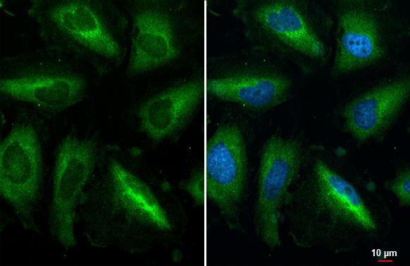 RPL32 antibody [HL2331] detects RPL32 protein at cytoplasm by immunofluorescent analysis.Sample: HeLa cells were fixed in 4% paraformaldehyde at RT for 15 min.Green: RPL32 stained by RPL32 antibody [HL2331] (NBP3-48676) diluted at 1:500.Blue: Fluoroshield with DAPI . 