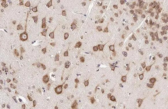 RPL32 antibody [HL2331] detects RPL32 protein at cytoplasm by immunohistochemical analysis.Sample: Paraffin-embedded rat brain.RPL32 stained by RPL32 antibody [HL2331] (NBP3-48676) diluted at 1:100.Antigen Retrieval: Citrate buffer, pH 6.0, 15 min 