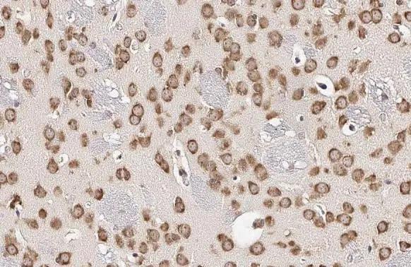 RPL32 antibody [HL2331] detects RPL32 protein at cytoplasm by immunohistochemical analysis.Sample: Paraffin-embedded mouse brain.RPL32 stained by RPL32 antibody [HL2331] (NBP3-48676) diluted at 1:100.Antigen Retrieval: Citrate buffer, pH 6.0, 15 min 