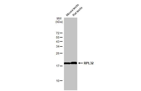 Various tissue extracts (50 ug) were separated by 15% SDS-PAGE, and the membrane was blotted with RPL32 antibody [HL2331] (NBP3-48676) diluted at 1:1000. The HRP-conjugated anti-rabbit IgG antibody was used to detect the primary antibody. 