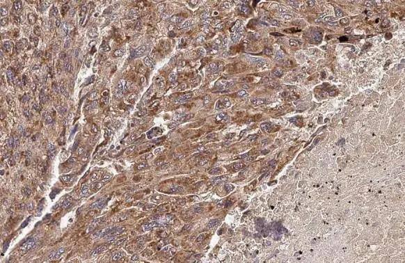 Immunohistochemistry-Paraffin PELO Antibody (HL2345)