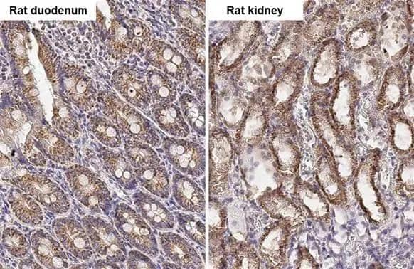 Immunohistochemistry-Paraffin PELO Antibody (HL2345)