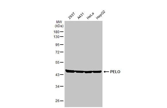 Western Blot PELO Antibody (HL2345)