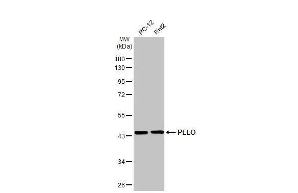 Western Blot PELO Antibody (HL2345)