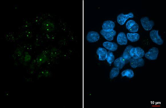 <b>Orthogonal Strategies Validation. </b>Coilin antibody [HL2384] detects Coilin protein at Cajal bodies by immunofluorescent analysis.Sample: A431 cells were fixed in ice-cold MeOH for 5 min.Green: Coilin stained by Coilin antibody [HL2384] (NBP3-48679) diluted at 1:500.Blue: Fluoroshield with DAPI . 