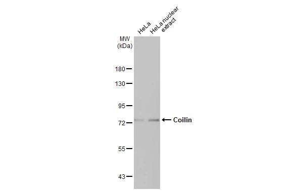 HeLa whole cell and nuclear extracts (30 ug) were separated by 7.5% SDS-PAGE, and the membrane was blotted with Coilin antibody [HL2384] (NBP3-48679) diluted at 1:1000. The HRP-conjugated anti-rabbit IgG antibody was used to detect the primary antibody. 