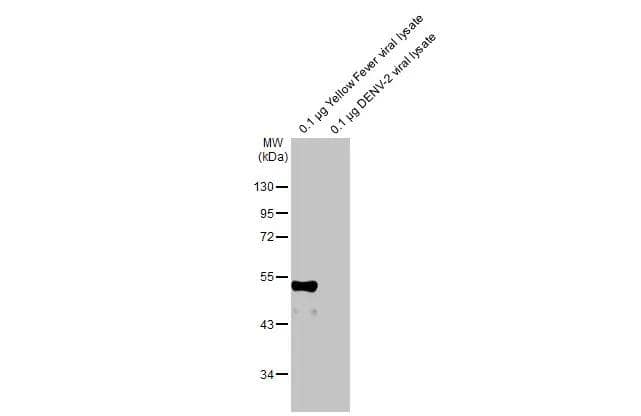 Various viral lysates (0.1 ug) were separated by 10% SDS-PAGE, and the membrane was blotted with Yellow Fever Virus Envelope antibody [HL2409] (NBP3-48682) diluted at 1:1000. The HRP-conjugated anti-rabbit IgG antibody was used to detect the primary antibody. 