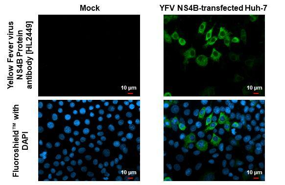 Yellow Fever Virus NS4B antibody [HL2449] detects Yellow Fever Virus NS4B protein by immunofluorescent analysis.Sample: Mock and transfected Huh-7 cells were fixed in ice-cold MeOH for 5 min.Green: Yellow Fever Virus NS4B stained by Yellow Fever Virus NS4B antibody [HL2449] (NBP3-48684) diluted at 1:500.Blue: Fluoroshield with DAPI . 