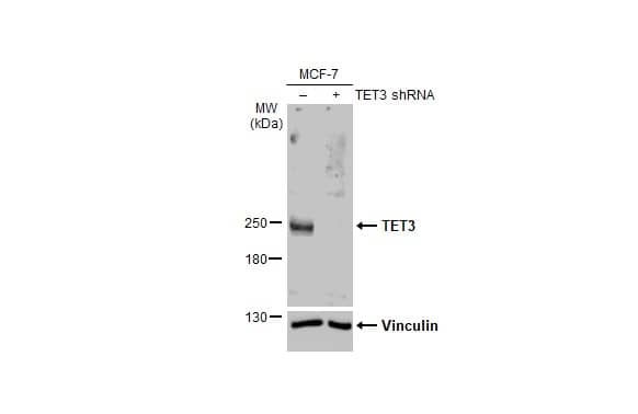 Non-transfected (-) and transfected (+) MCF-7 whole cell extracts (30 ug) were separated by 5% SDS-PAGE, and the membrane was blotted with TET3 antibody [HL2463] (NBP3-48685) diluted at 1:1000. The HRP-conjugated anti-rabbit IgG antibody was used to detect the primary antibody, and the signal was developed with Trident ECL plus-Enhanced. 
