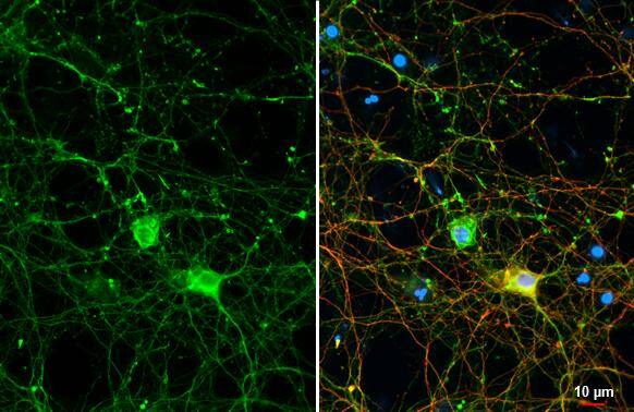 Immunocytochemistry/ Immunofluorescence GPM6A Antibody (HL2473)