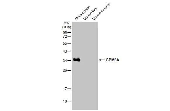 Western Blot GPM6A Antibody (HL2473)
