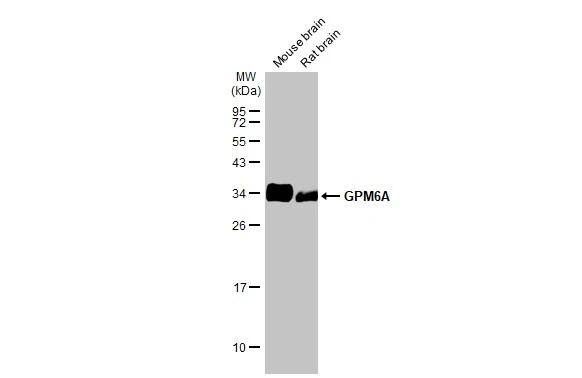 Western Blot GPM6A Antibody (HL2473)