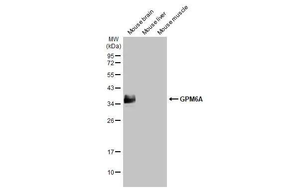 Various tissue extracts (30 ug) were separated by 12% SDS-PAGE, and the membrane was blotted with GPM6A antibody [HL2474] (NBP3-48687) diluted at 1:10000. The HRP-conjugated anti-rabbit IgG antibody was used to detect the primary antibody. 