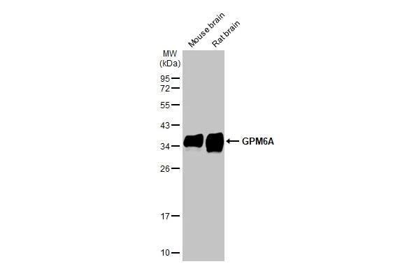 Various tissue extracts (50 ug) were separated by 12% SDS-PAGE, and the membrane was blotted with GPM6A antibody [HL2474] (NBP3-48687) diluted at 1:50000. The HRP-conjugated anti-rabbit IgG antibody was used to detect the primary antibody. 
