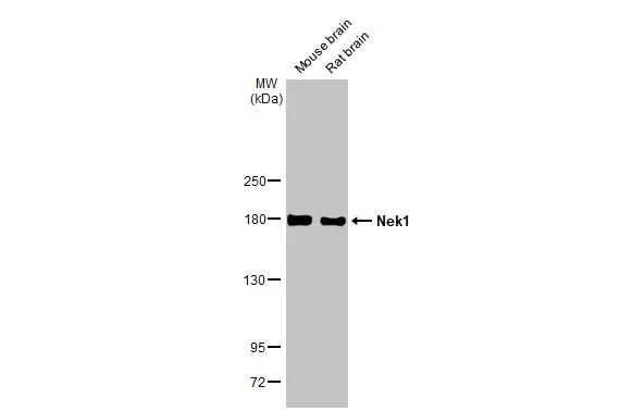 Various tissue extracts (50 ug) were separated by 5% SDS-PAGE, and the membrane was blotted with NEK1 antibody [HL2489] (NBP3-48690) diluted at 1:1000. The HRP-conjugated anti-rabbit IgG antibody was used to detect the primary antibody. 