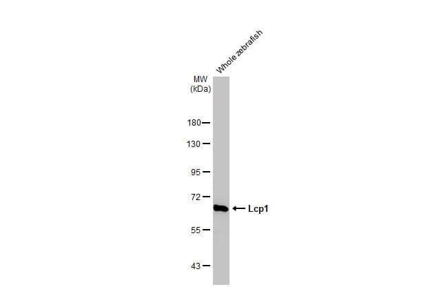 Whole zebrafish extract (30 ug) was separated by 7.5% SDS-PAGE, and the membrane was blotted with Plastin L antibody [HL2501] (NBP3-48691) diluted at 1:1000. The HRP-conjugated anti-rabbit IgG antibody was used to detect the primary antibody. 