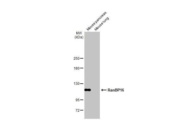 <b>Genetic Strategies Validation. </b>Various tissue extracts (50 ug) were separated by 5% SDS-PAGE, and the membrane was blotted with RanBP16 antibody [HL2510] (NBP3-48692) diluted at 1:1000. The HRP-conjugated anti-rabbit IgG antibody was used to detect the primary antibody. 