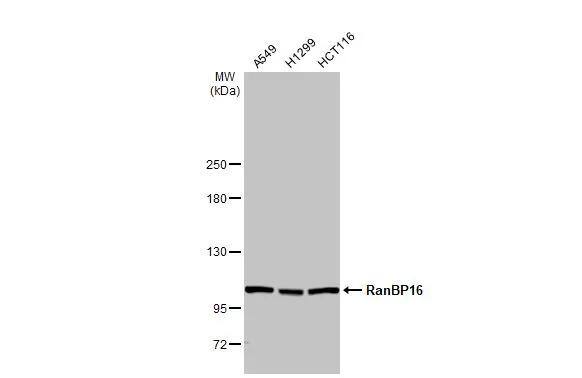 Various whole cell extracts (30 ug) were separated by 5% SDS-PAGE, and the membrane was blotted with RanBP16 antibody [HL2510] (NBP3-48692) diluted at 1:1000. The HRP-conjugated anti-rabbit IgG antibody was used to detect the primary antibody. 
