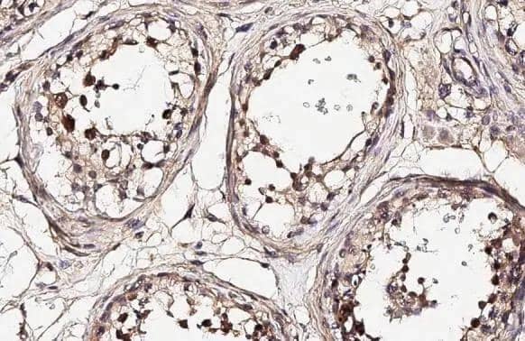 NEK2 antibody [HL2511] detects NEK2 protein at nucleus by immunohistochemical analysis.Sample: Paraffin-embedded human testis.NEK2 stained by NEK2 antibody [HL2511] (NBP3-48693) diluted at 1:200.Antigen Retrieval: Citrate buffer, pH 6.0, 15 min 