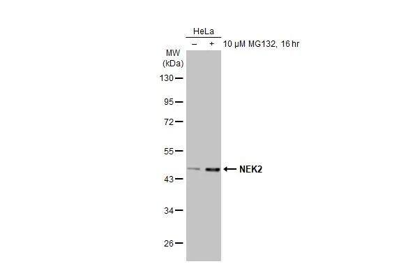 Untreated (-) and treated (+) HeLa whole cell extracts (30 ug) were separated by 10% SDS-PAGE, and the membrane was blotted with NEK2 antibody [HL2511] (NBP3-48693) diluted at 1:1000. The HRP-conjugated anti-rabbit IgG antibody was used to detect the primary antibody. 