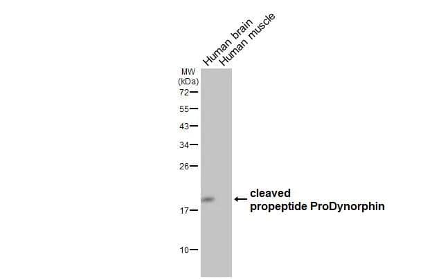 Various tissue extracts (5 ug) were separated by 12% SDS-PAGE, and the membrane was blotted with PDYN antibody [HL2573] (NBP3-48699) diluted at 1:500. The HRP-conjugated anti-rabbit IgG antibody was used to detect the primary antibody. 