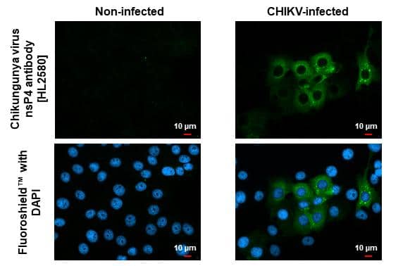 Immunofluorescent analysis of Chikungunya virus infected cells using Chikungunya Virus nsp4 antibody [HL2580] antibody (NBP3-48702).Sample: Chikungunya virus infected cells slide.Green: Chikungunya Virus nsp4 antibody [HL2580] antibody (NBP3-48702) diluted at 1:100.Blue: Fluoroshield with DAPI . 