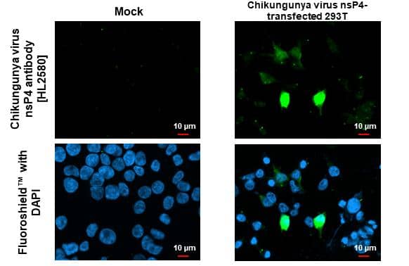 Chikungunya Virus nsp4 antibody [HL2580] detects Chikungunya Virus nsp4 protein by immunofluorescent analysis.Sample: Mock and transfected 293T cells were fixed in 4% paraformaldehyde at RT for 15 min.Green: Chikungunya Virus nsp4 stained by Chikungunya Virus nsp4 antibody [HL2580] (NBP3-48702) diluted at 1:500.Blue: Fluoroshield with DAPI . 