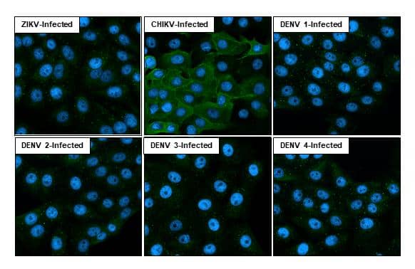 Immunocytochemistry/ Immunofluorescence Chikungunya Virus nsp1 Antibody (HL2605)