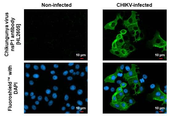 Immunocytochemistry/ Immunofluorescence Chikungunya Virus nsp1 Antibody (HL2605)