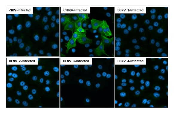 Immunocytochemistry/ Immunofluorescence Chikungunya Virus nsp1 Antibody (HL2608)