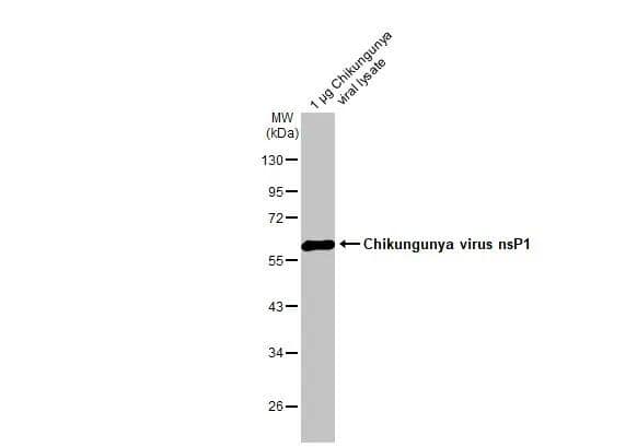 Western Blot Chikungunya Virus nsp1 Antibody (HL2608)