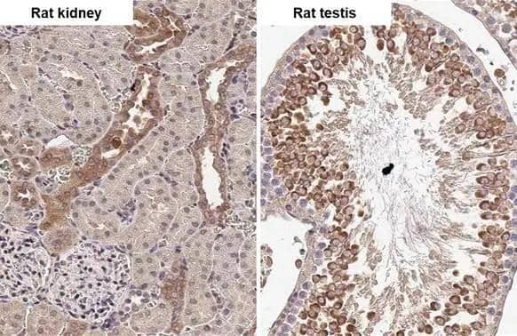 ADAMTSL2 antibody [HL2616] detects ADAMTSL2 protein by immunohistochemical analysis.Sample: Paraffin-embedded rat tissues.ADAMTSL2 stained by ADAMTSL2 antibody [HL2616] (NBP3-48706) diluted at 1:100.Antigen Retrieval: Citrate buffer, pH 6.0, 15 min 