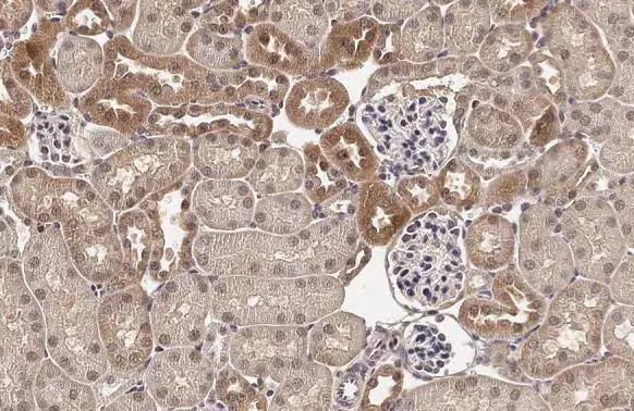 ADAMTSL2 antibody [HL2616] detects secreted ADAMTSL2 protein by immunohistochemical analysis.Sample: Paraffin-embedded mouse kidney.ADAMTSL2 stained by ADAMTSL2 antibody [HL2616] (NBP3-48706) diluted at 1:100.Antigen Retrieval: Citrate buffer, pH 6.0, 15 min 