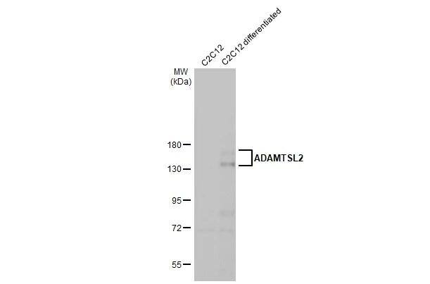 <b>Orthogonal Strategies Validation. </b>C2C12 whole cell and differentiated (30 ug) were separated by 7.5% SDS-PAGE, and the membrane was blotted with ADAMTSL2 antibody [HL2616] (NBP3-48706) diluted at 1:1000. The HRP-conjugated anti-rabbit IgG antibody was used to detect the primary antibody, and the signal was developed with Trident ECL plus-Enhanced. 