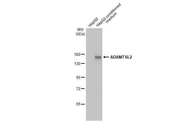 <b>Orthogonal Strategies Validation. </b>HepG2 whole cell extract and conditioned medium (30 ug) were separated by 7.5% SDS-PAGE, and the membrane was blotted with ADAMTSL2 antibody [HL2616] (NBP3-48706) diluted at 1:1000. The HRP-conjugated anti-rabbit IgG antibody was used to detect the primary antibody. 