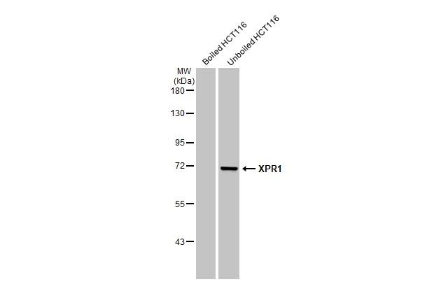 Boiled and unboiled HCT116 whole cell extracts (30 ug) were separated by 7.5% SDS-PAGE, and the membrane was blotted with XPR1 antibody [HL2631] (NBP3-48708) diluted at 1:1000. The HRP-conjugated anti-rabbit IgG antibody was used to detect the primary antibody. 